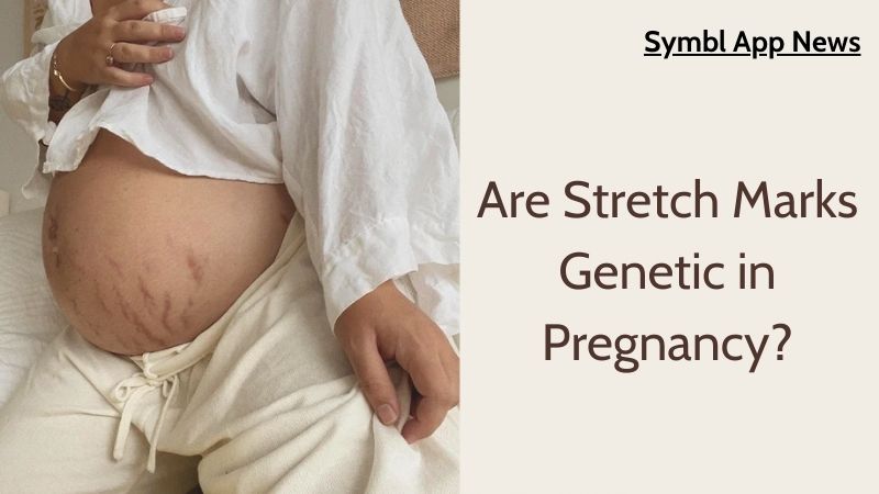 Are Stretch Marks Genetic in Pregnancy?